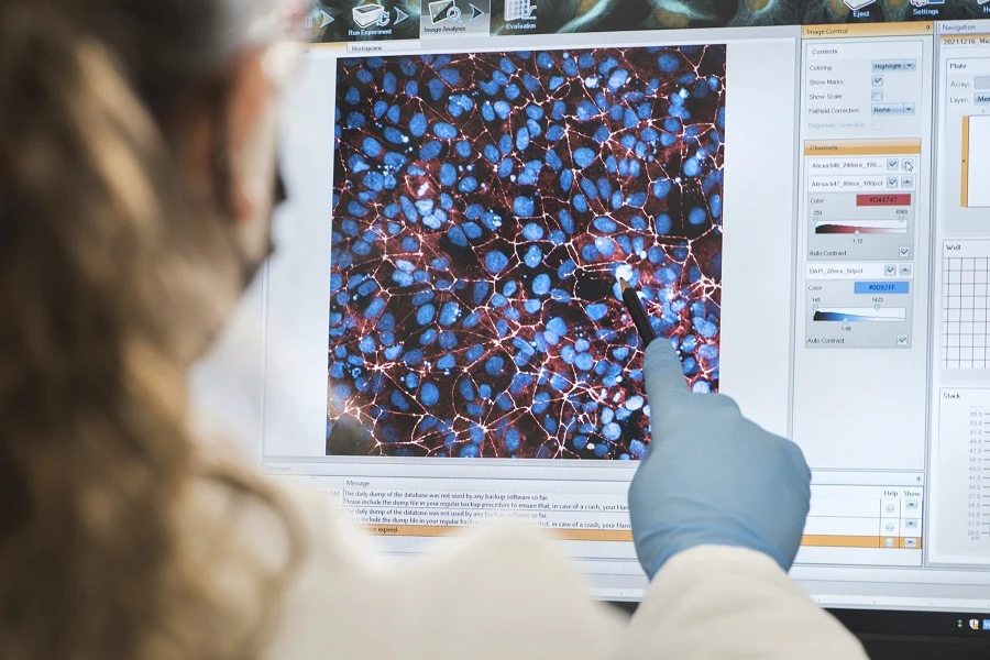 Sildenafil Shows Promise for Leigh Syndrome Patients