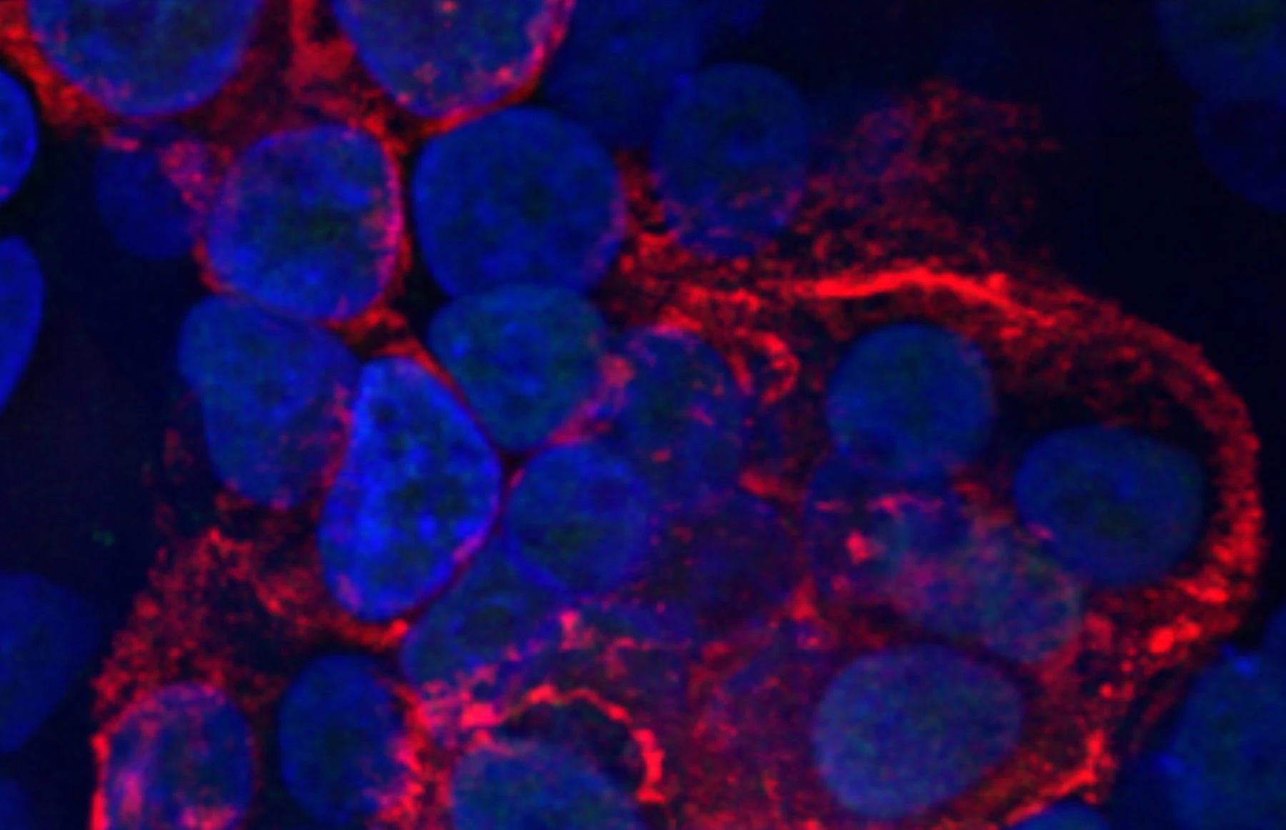Study reveals Covid-19 virus alters lung cells for spread
