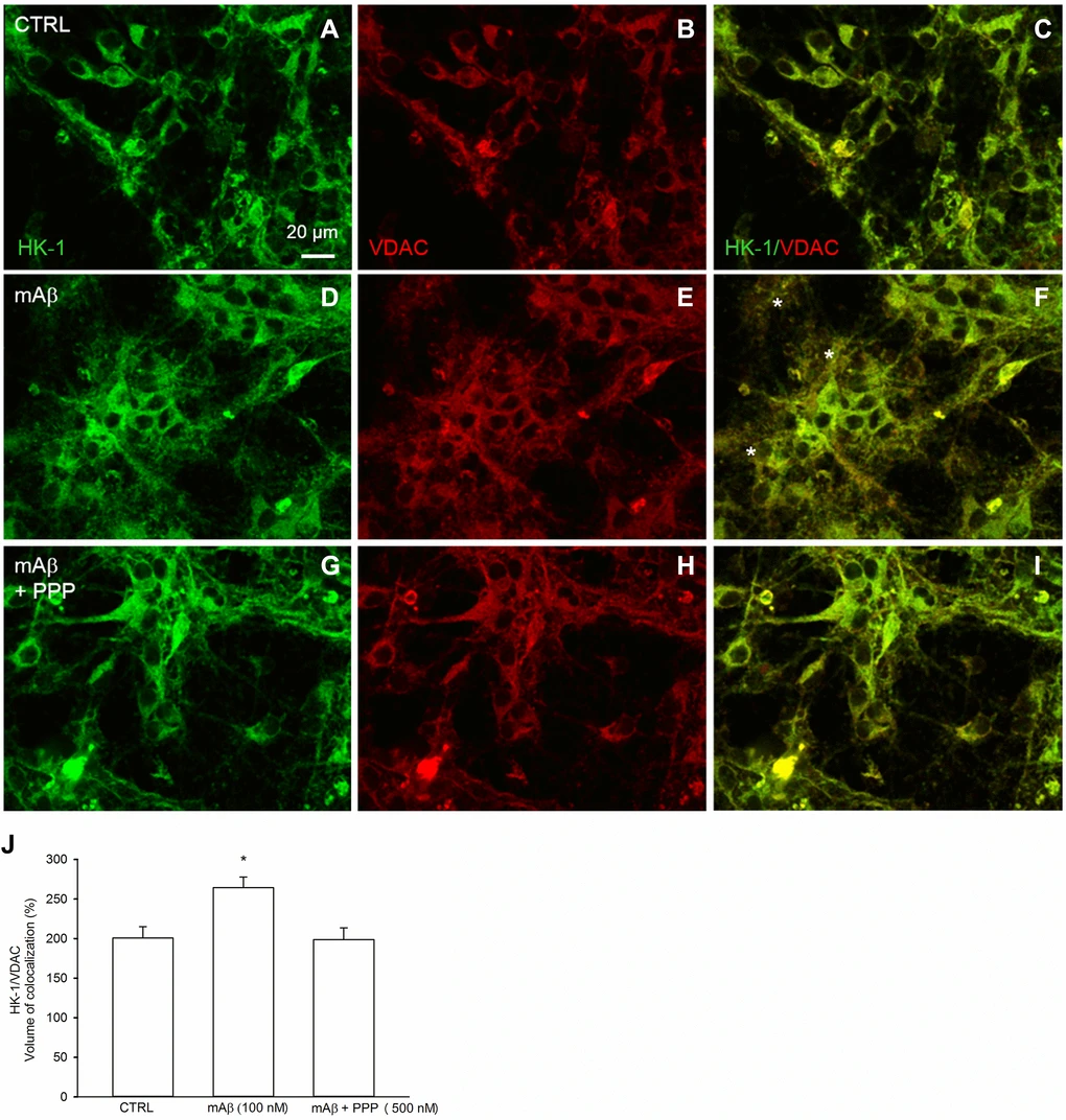 Neurobiology of Aging retracts key amyloid-β study